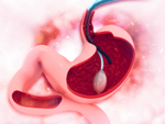 Illustration article